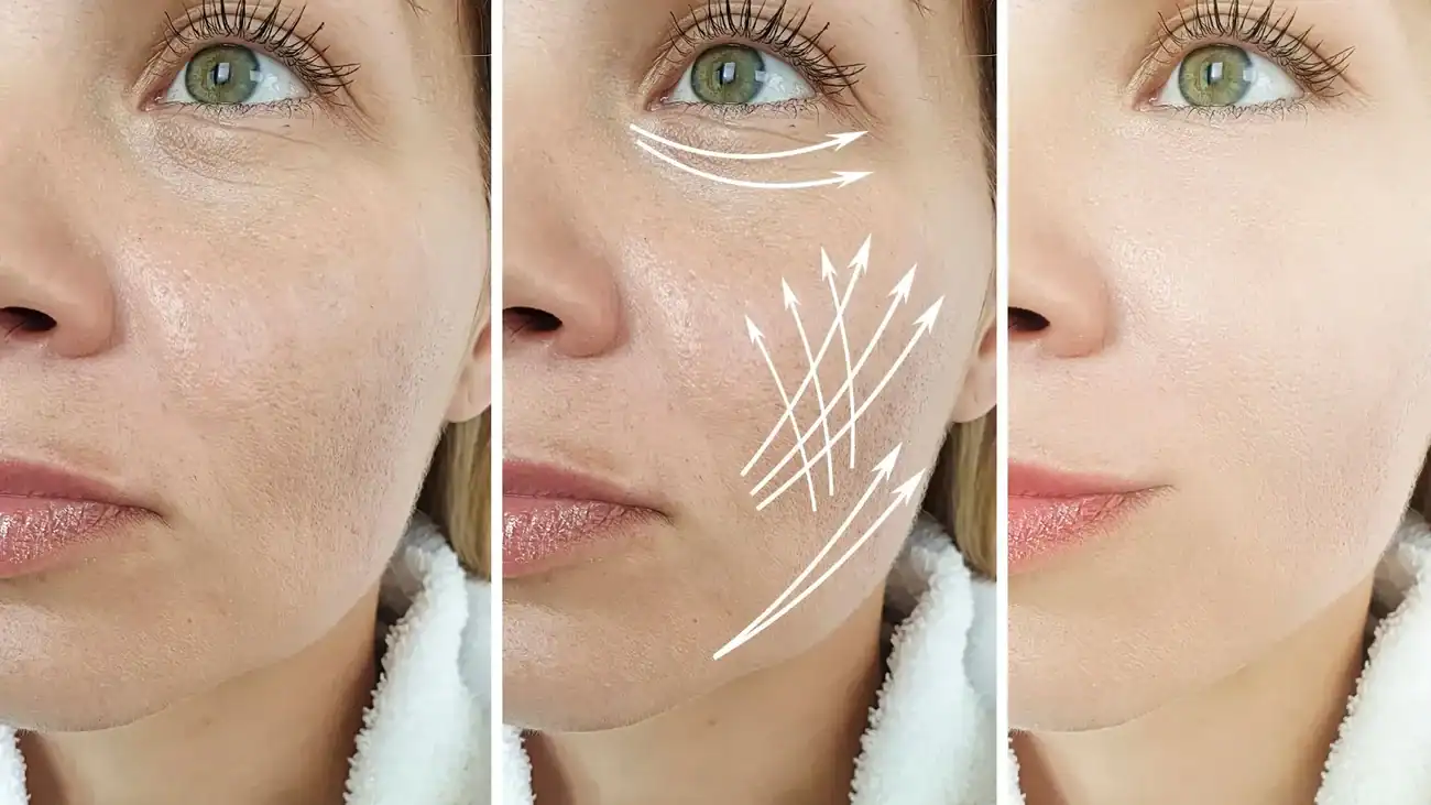 Can One Treatment Really Tackle More Than One Skin Concern Houghton Regis?