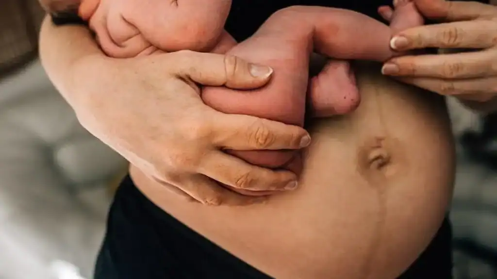 Why Is My Stomach Still Big After Pregnancy Houghton Regis?